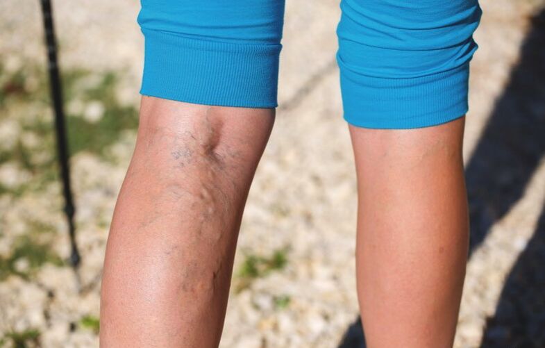 Daño a las extremidades inferiores