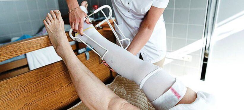 medias de compresión para el tratamiento de las venas varicosas